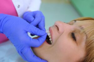 Woman getting her permanent veneers placed